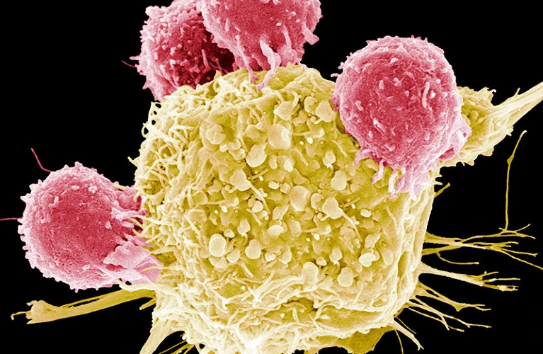 भारत ने बनाई कैंसर को निस्तनाबूद करने की नई थेरेपी